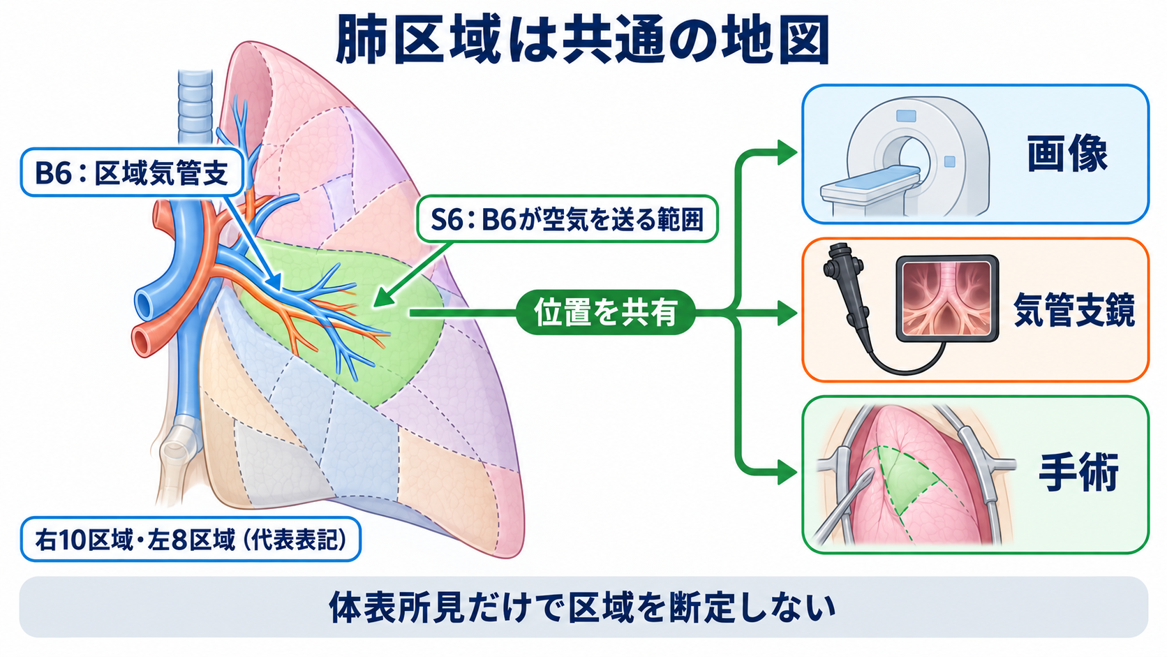 肺の解剖を臨床につなげる：肺葉・肺区域・肺胞・胸膜と看護観察：肺区域は肺葉をさらに分けた、画像・気管支鏡・手術の共通地図の図解