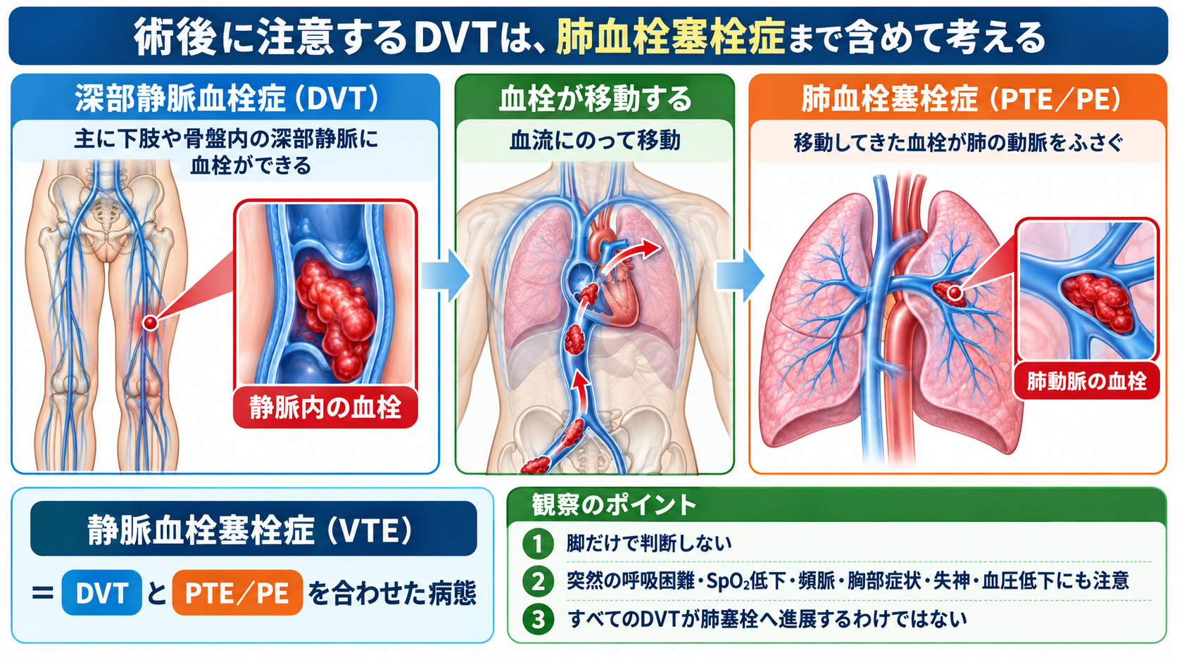 深部静脈血栓症を起こしやすい手術とは？術後DVTのリスクと予防・看護観察を解説：術後に注意するDVTは、肺血栓塞栓症まで含めて考えるの図解
