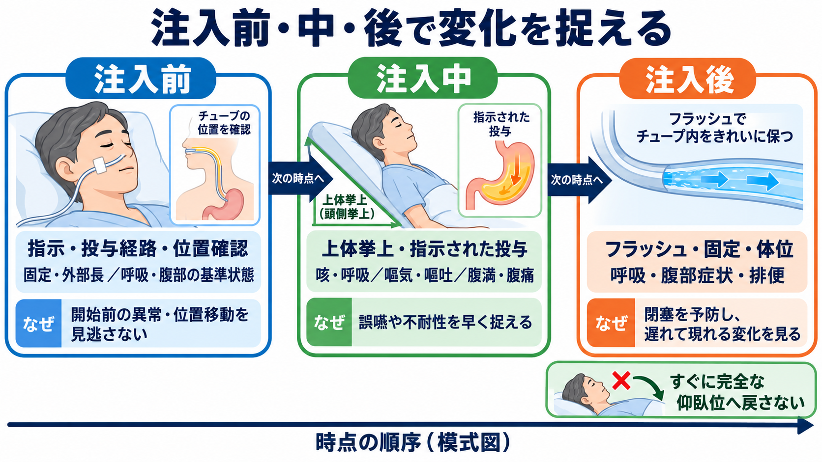 経鼻経管栄養の使い方｜体位の基本とチューブ位置確認、誤嚥・閉塞を防ぐ注意点：使い方は「注入前→注入中→注入後」の順に安全確認すると整理しやすいの図解