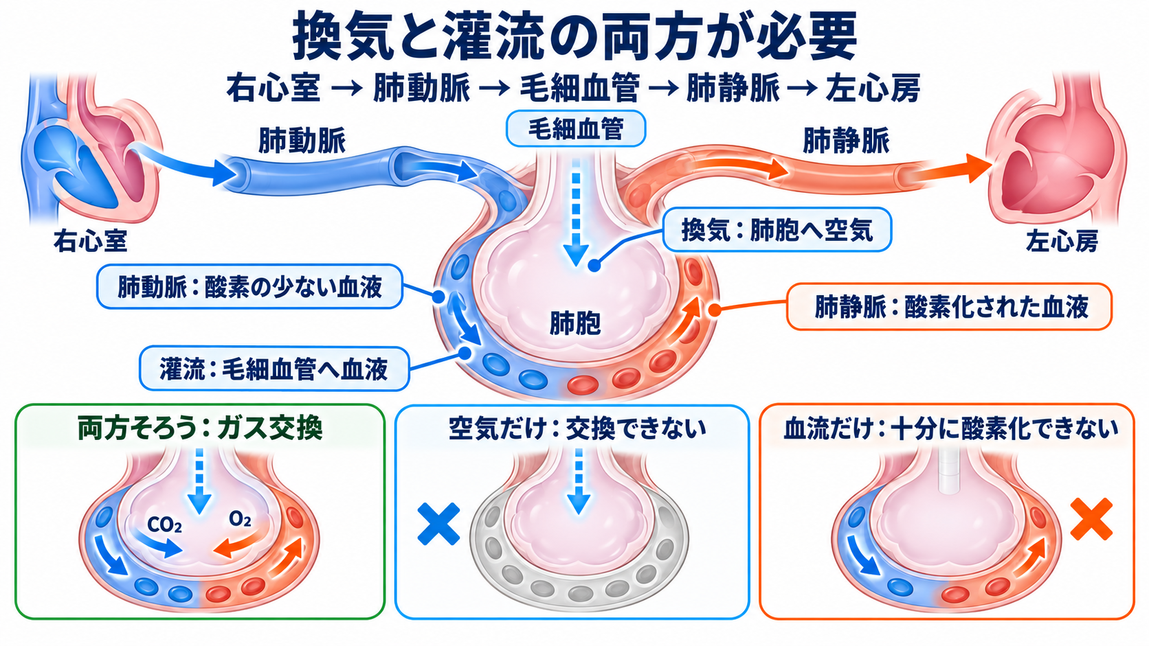 肺の解剖を臨床につなげる：肺葉・肺区域・肺胞・胸膜と看護観察：肺循環は「空気のある肺胞」へ血液を届けて初めて役割を果たすの図解
