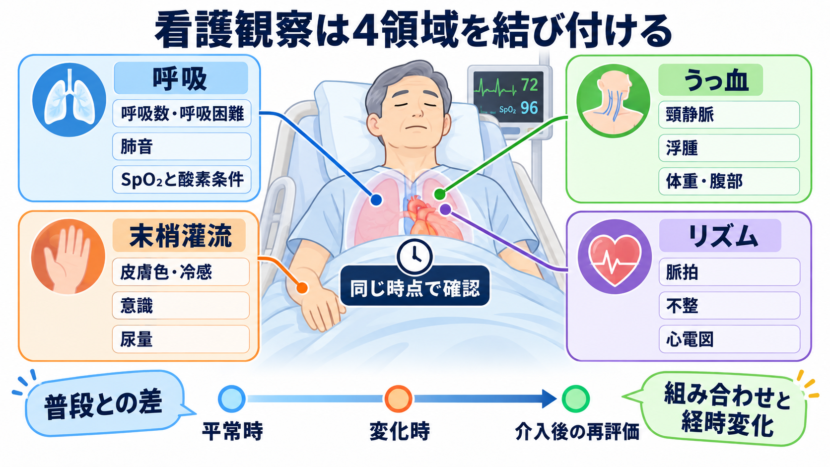 心臓の解剖を血流から理解する｜4つの部屋・弁・冠動脈・刺激伝導系と看護観察：看護観察は、呼吸・うっ血・末梢灌流・リズムを経時的に結び付けるの図解