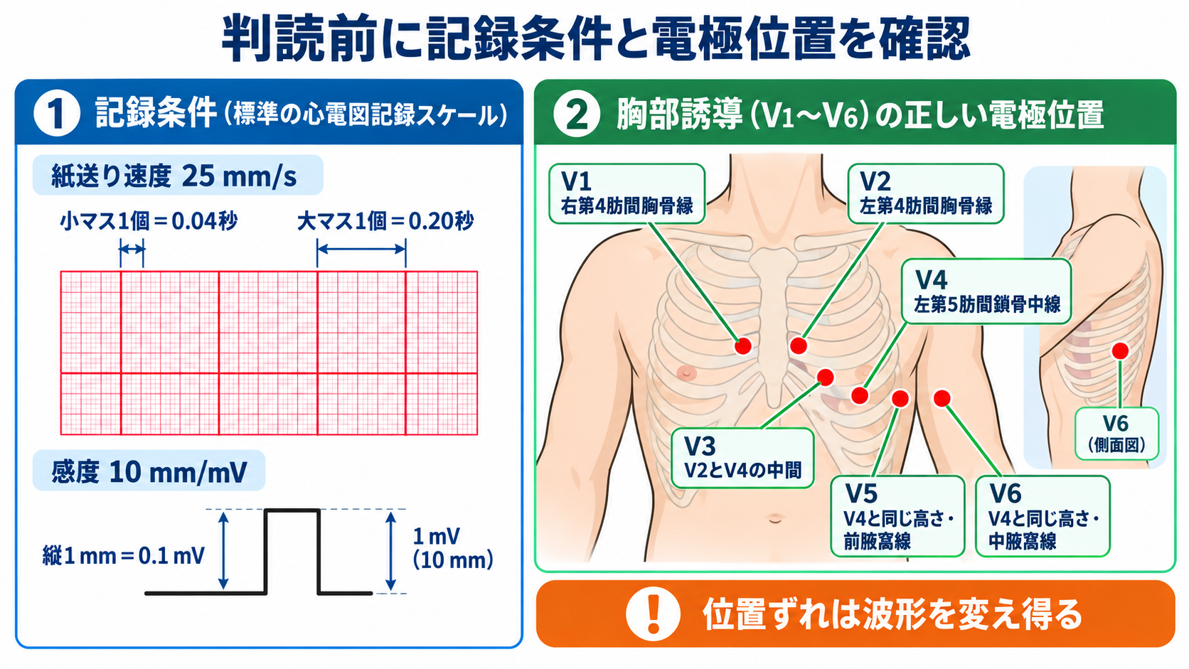 心電図の読み方を基礎から整理｜新人看護師・看護学生のための判読手順と緊急波形：判読前に紙送り速度、感度、電極位置を確認するの図解