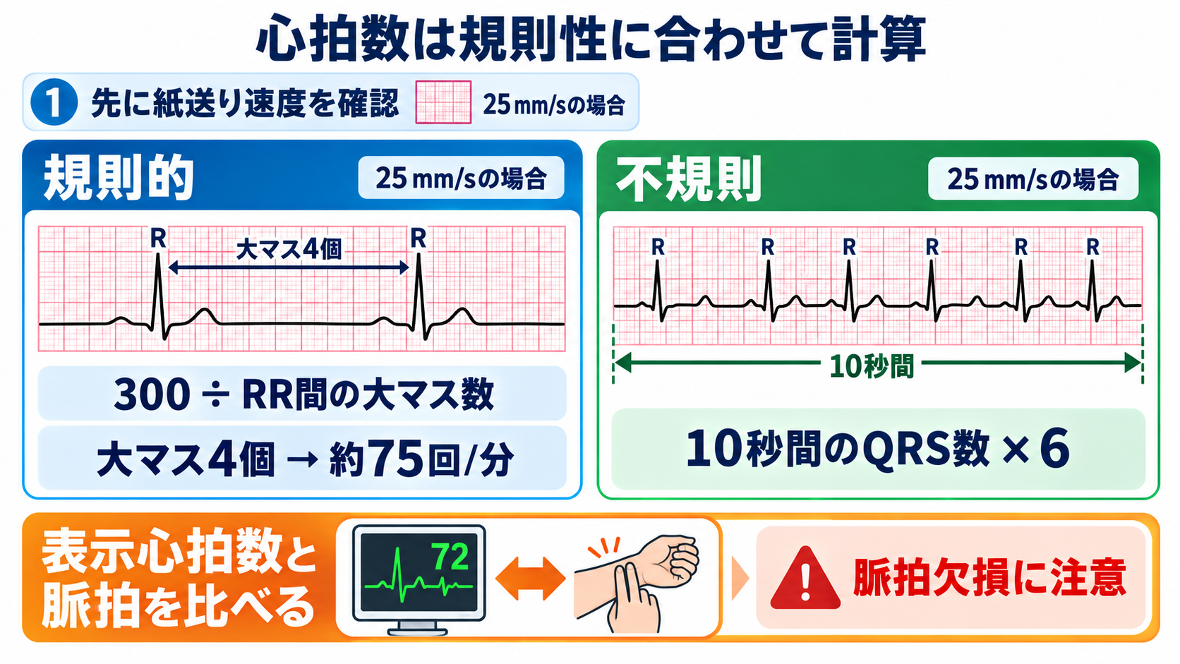 心電図の読み方を基礎から整理｜新人看護師・看護学生のための判読手順と緊急波形：心拍数はリズムの規則性に合わせて計算するの図解