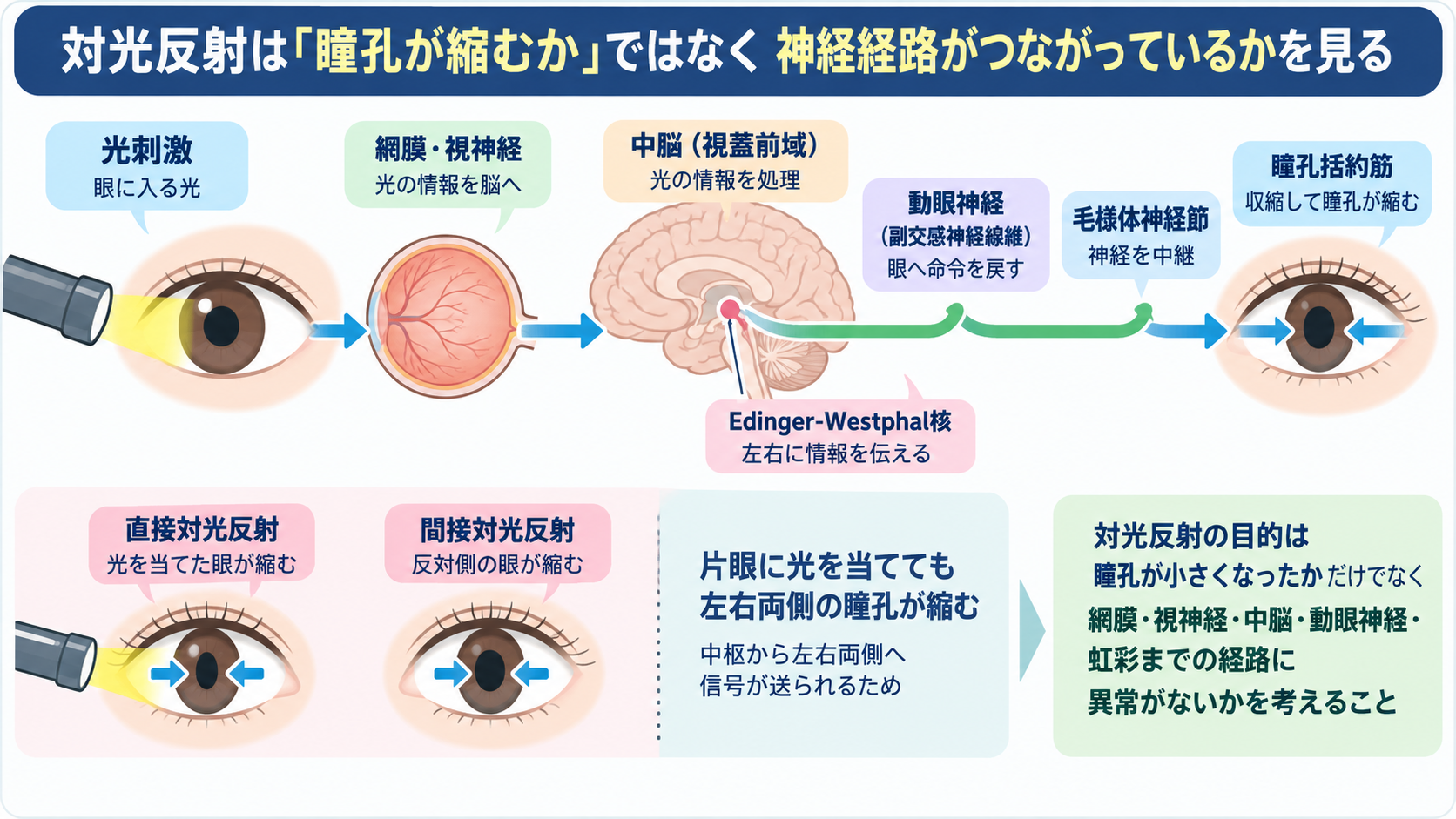 対光反射の見かた｜散瞳・縮瞳・瞳孔不同を症状別に理解する：新しい瞳孔不同に意識低下が加わったら頭蓋内の変化も考えるの図解