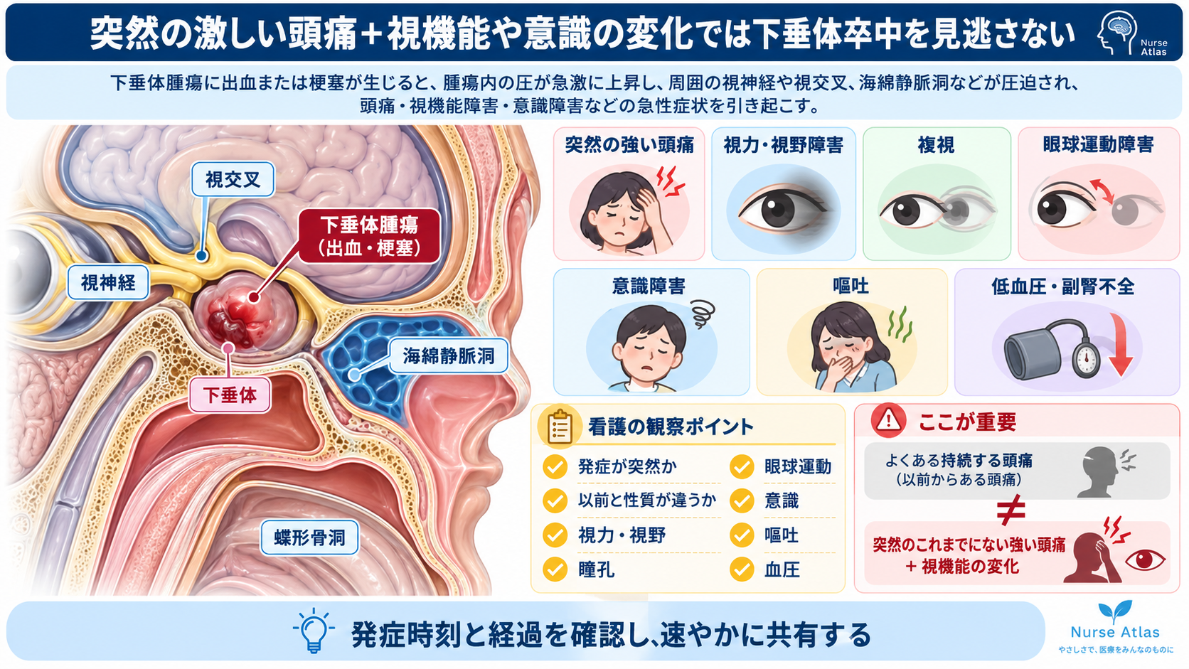 脳下垂体腫瘍とは？症状・ホルモン異常・治療と術後看護の観察ポイント：突然の激しい頭痛＋視機能や意識の変化では下垂体卒中を見逃さないの図解