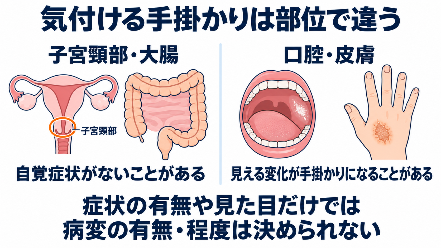 前がん病変とは？自分で気付くことの限界と、検査・看護のポイント：自分で気付けるかは部位によって異なり、無症状でも病変は否定できないの図解