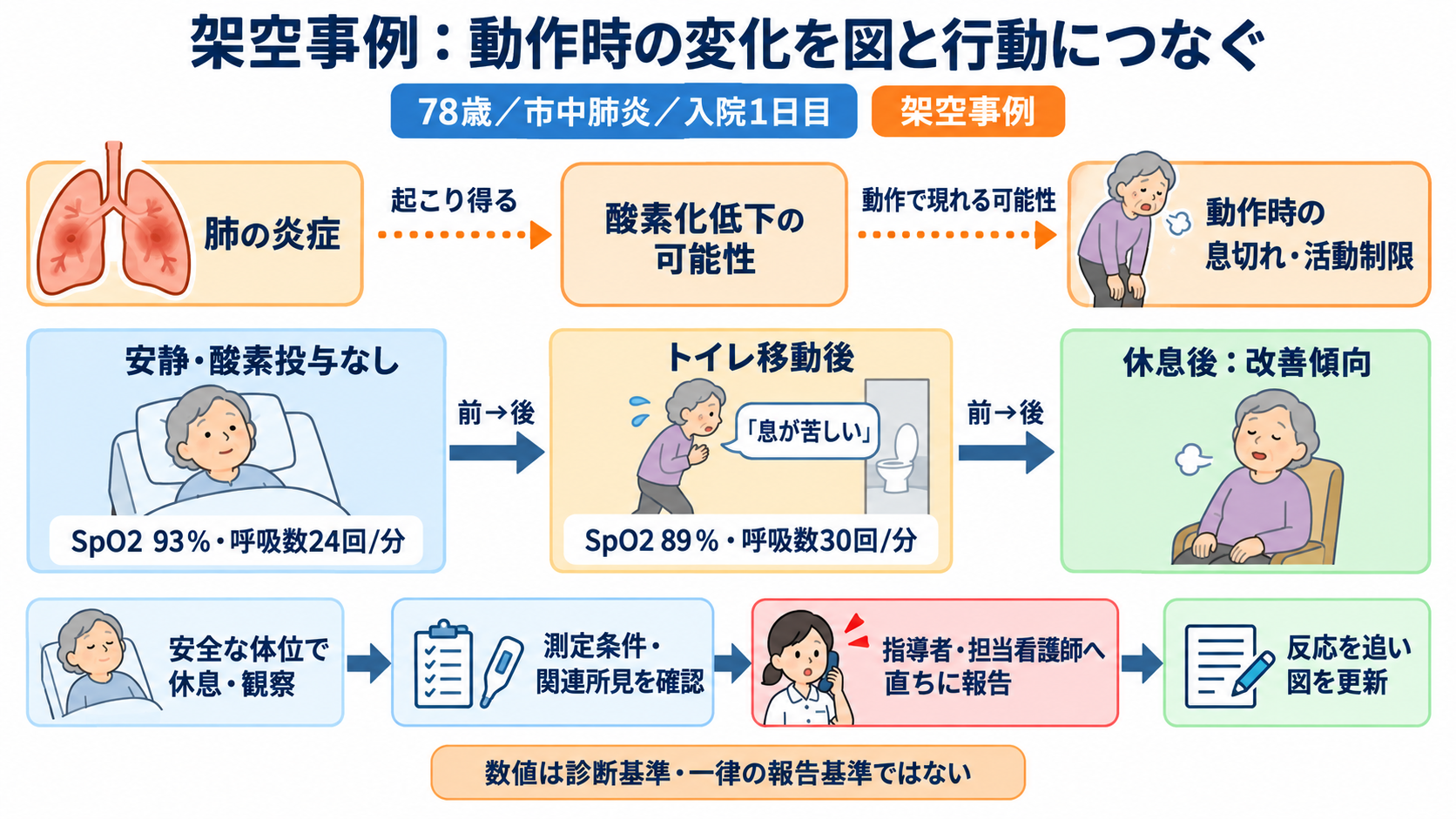 関連図の書き方を6ステップで解説｜患者情報・病態・看護をつなぐ考え方：架空事例で確認｜高齢の肺炎患者を関連図にする流れの図解