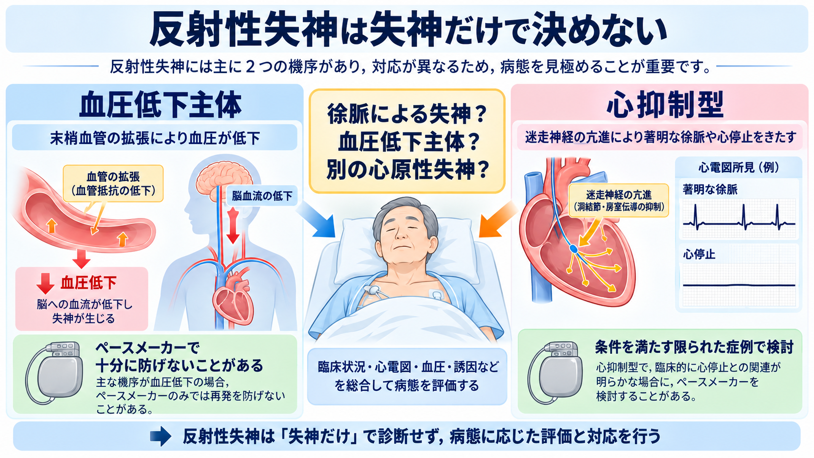 ペースメーカーの種類と適応を整理する｜VVI・DDD・リードレスから看護観察まで：反射性失神は「失神があるからペースメーカー」ではないの図解