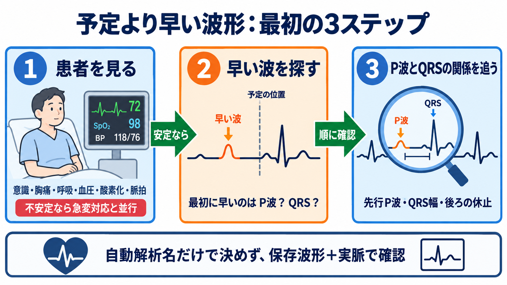 予定よりP波・QRS波が早いときの読み方――PVC、間入性・代償性休止期、副収縮、SVPCの見分け方と分類：最初の結論は「患者を見る→早い波を探す→P波とQRSの関係を追う」の図解