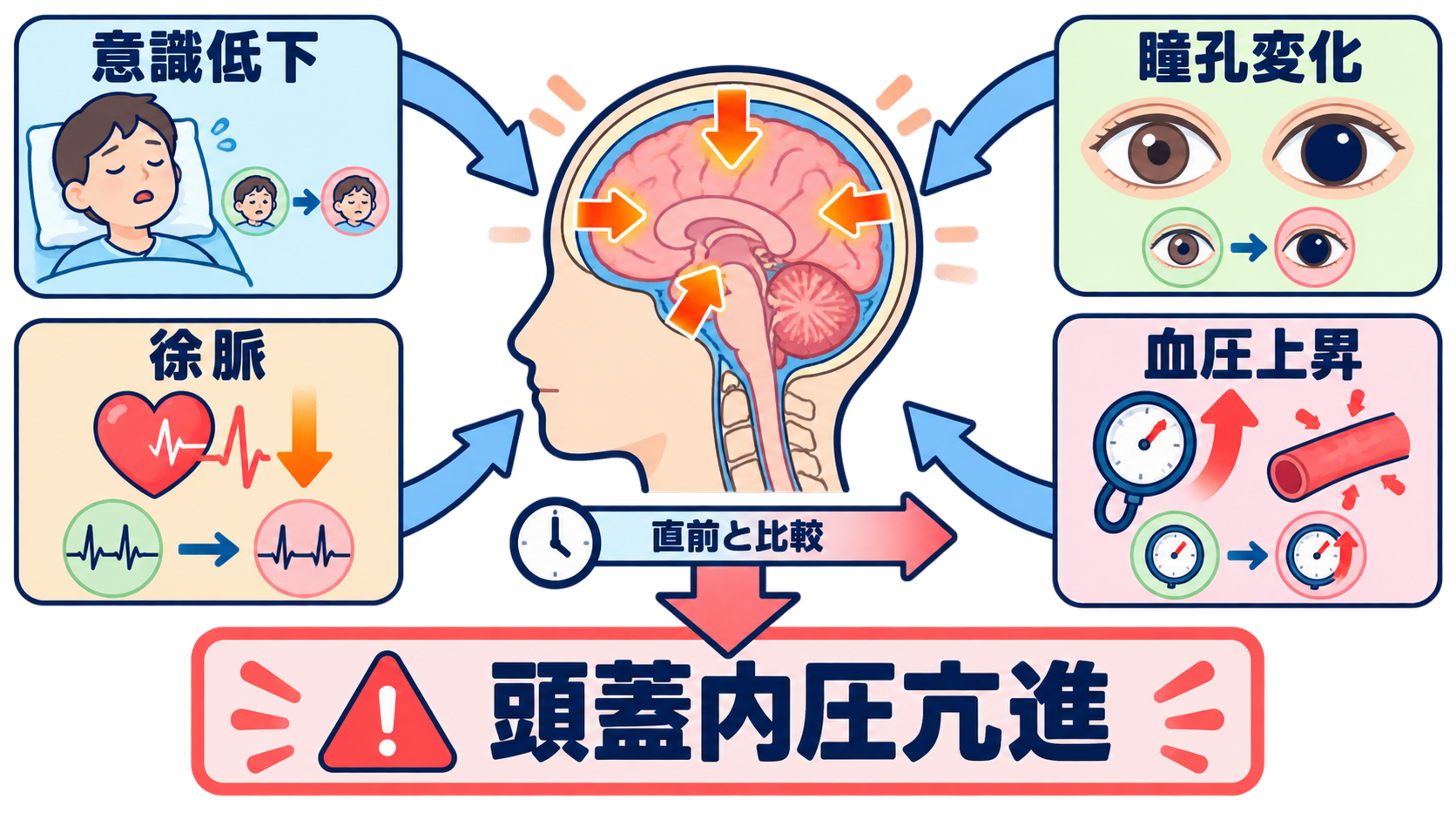 髄膜炎とは？症状・髄液所見・治療の流れと看護で見るポイントをわかりやすく解説：意識低下・瞳孔変化・徐脈と血圧上昇は頭蓋内圧亢進を考えるの図解