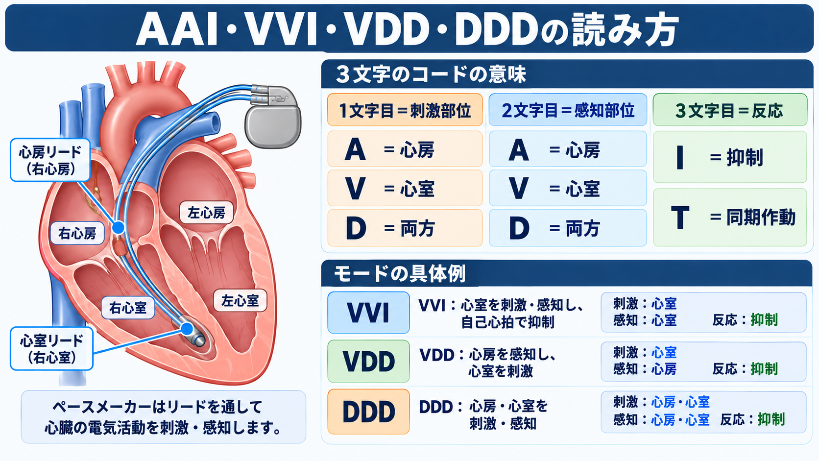 ペースメーカーの種類と適応を整理する｜VVI・DDD・リードレスから看護観察まで：AAI・VVI・DDDは「どこを感知し、どこを刺激するか」を示しているの図解