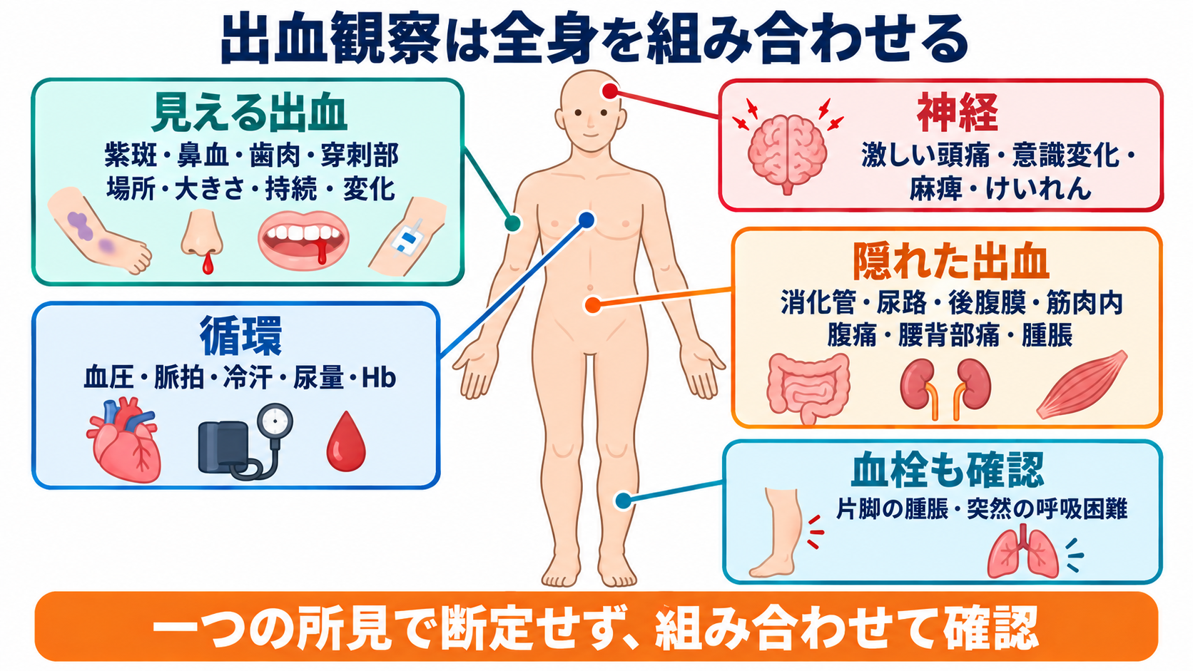抗凝固薬と抗血小板薬の違いは？看護師が押さえる選び方と出血観察：出血観察は「見える血」だけでなく、循環・神経・臓器症状を組み合わせるの図解