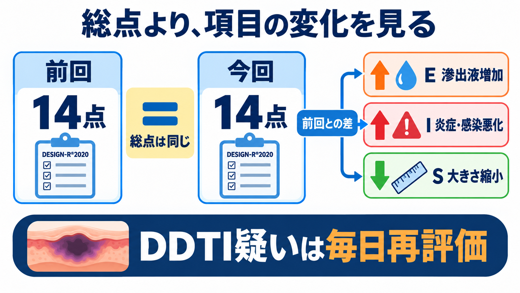 褥瘡の段階はどう伝える？DESIGN-R®2020で皮膚状況を観察・報告する方法：経時評価では総点より先に「どの項目がどう変わったか」を見るの図解