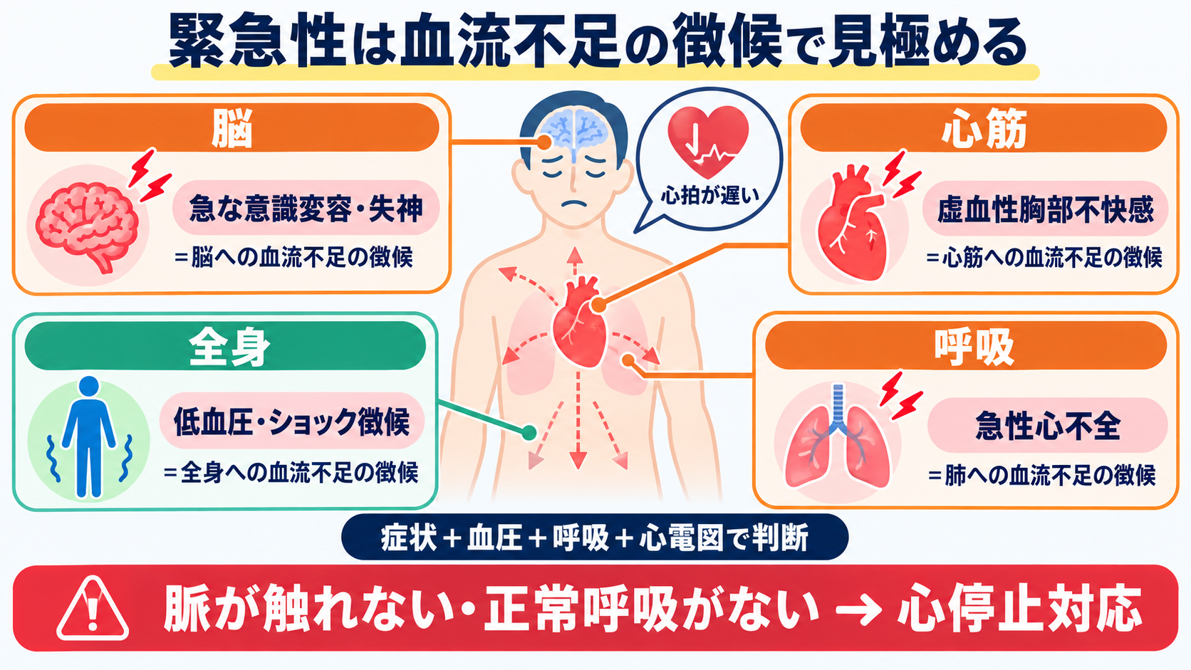 徐脈をどう見分ける？洞徐脈・SSS・徐脈頻脈症候群・房室ブロックの心電図と看護：緊急性は、脳・心筋・全身への血流不足を示す症状で見極めるの図解