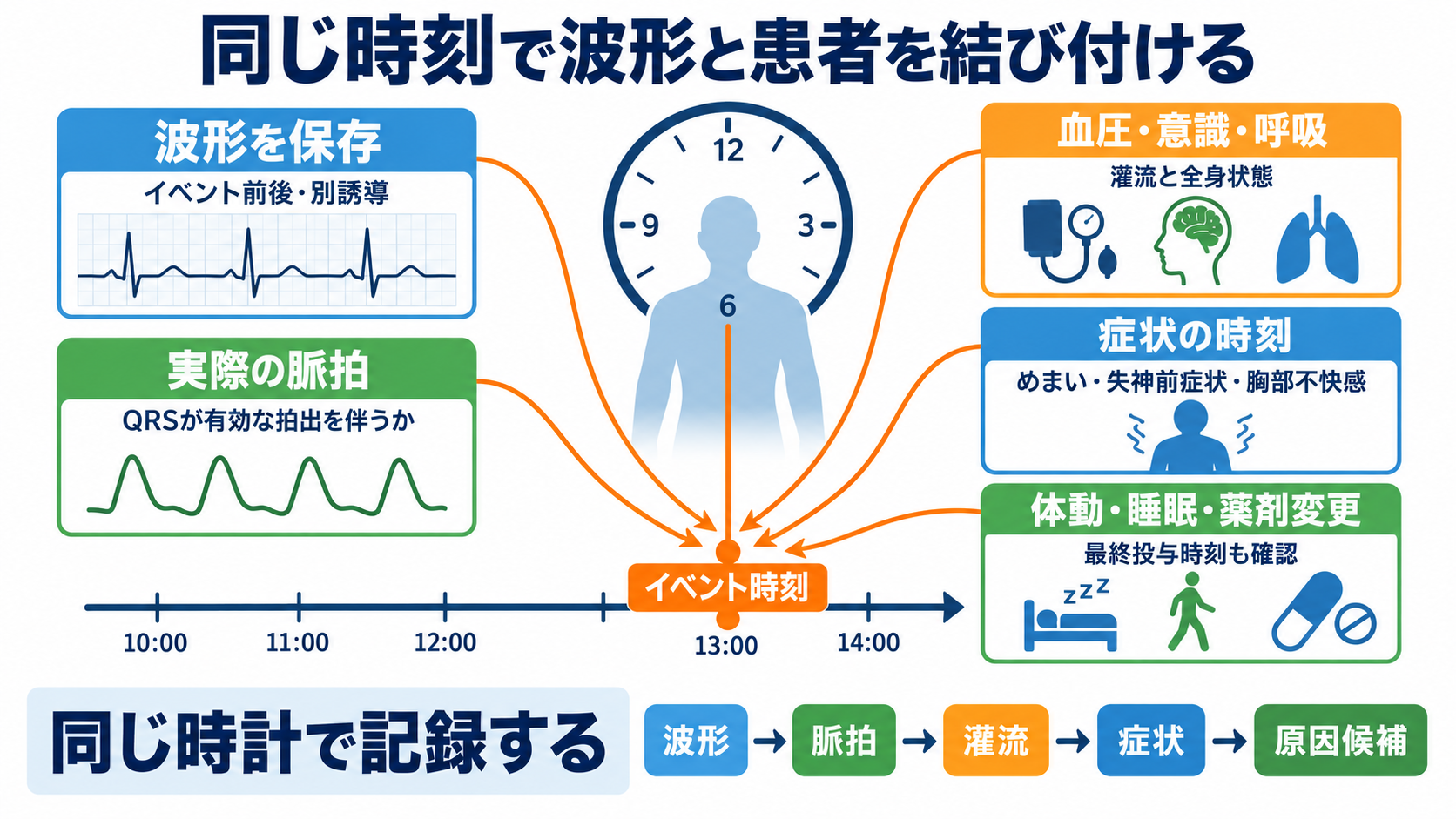 心電図でP波・QRS波が予定位置にないときの見分け方―洞停止、洞房ブロック、房室ブロック、ブロックSVPC：看護観察は波形、脈拍、灌流、症状、原因候補を同じ時刻で結び付けるの図解