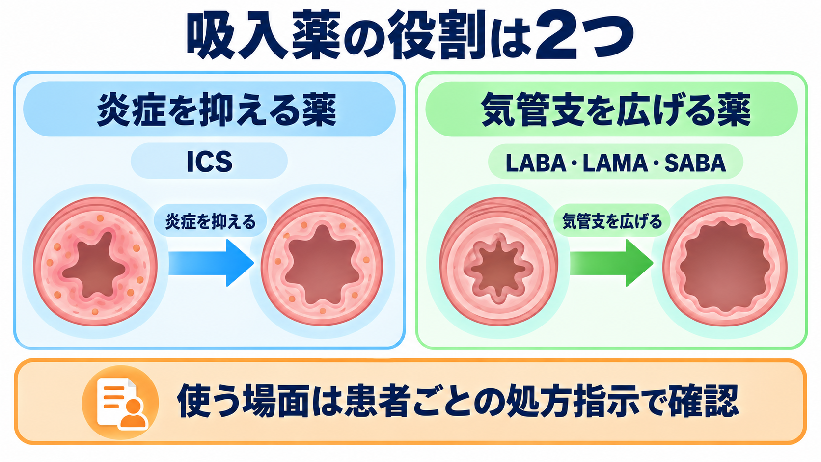 吸入薬の使い方が分かる｜薬の種類・デバイス・うがい・吸入指導の基本：薬の種類は「炎症を抑える薬」と「気管支を広げる薬」に分けて考えるの図解