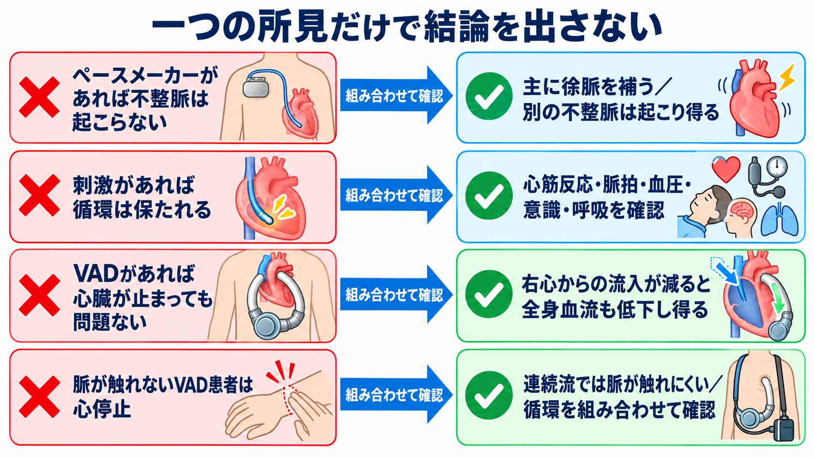 ペースメーカーとVADの違いとは？仕組み・適応・看護観察を循環の視点で整理：よくある誤解を解くと、観察の優先順位が見えるの図解