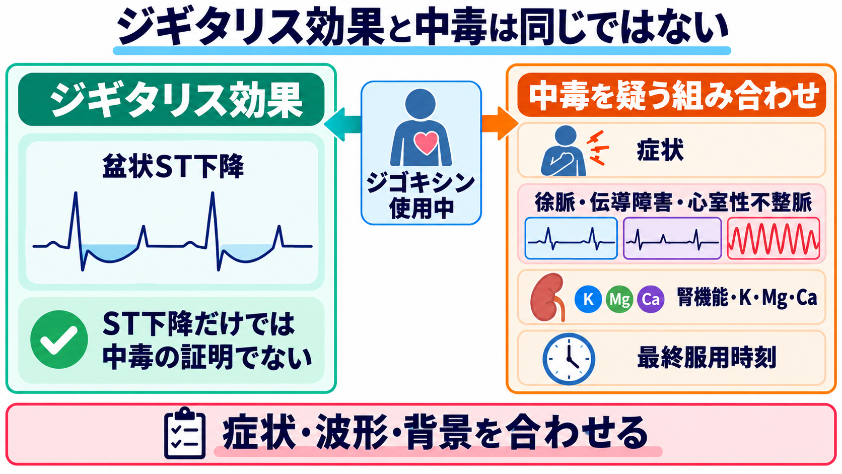 ST下降をどう読む？心筋虚血・心内膜下梗塞と二次性変化、薬剤・電解質異常の見分け方：ジギタリス効果のST下降は服薬の影響を示すが、中毒は症状と不整脈を合わせて疑うの図解