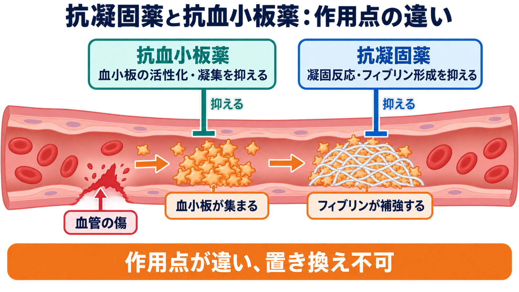 抗凝固薬と抗血小板薬の違いは？看護師が押さえる選び方と出血観察：抗凝固薬と抗血小板薬は、止血の異なる段階に作用するの図解