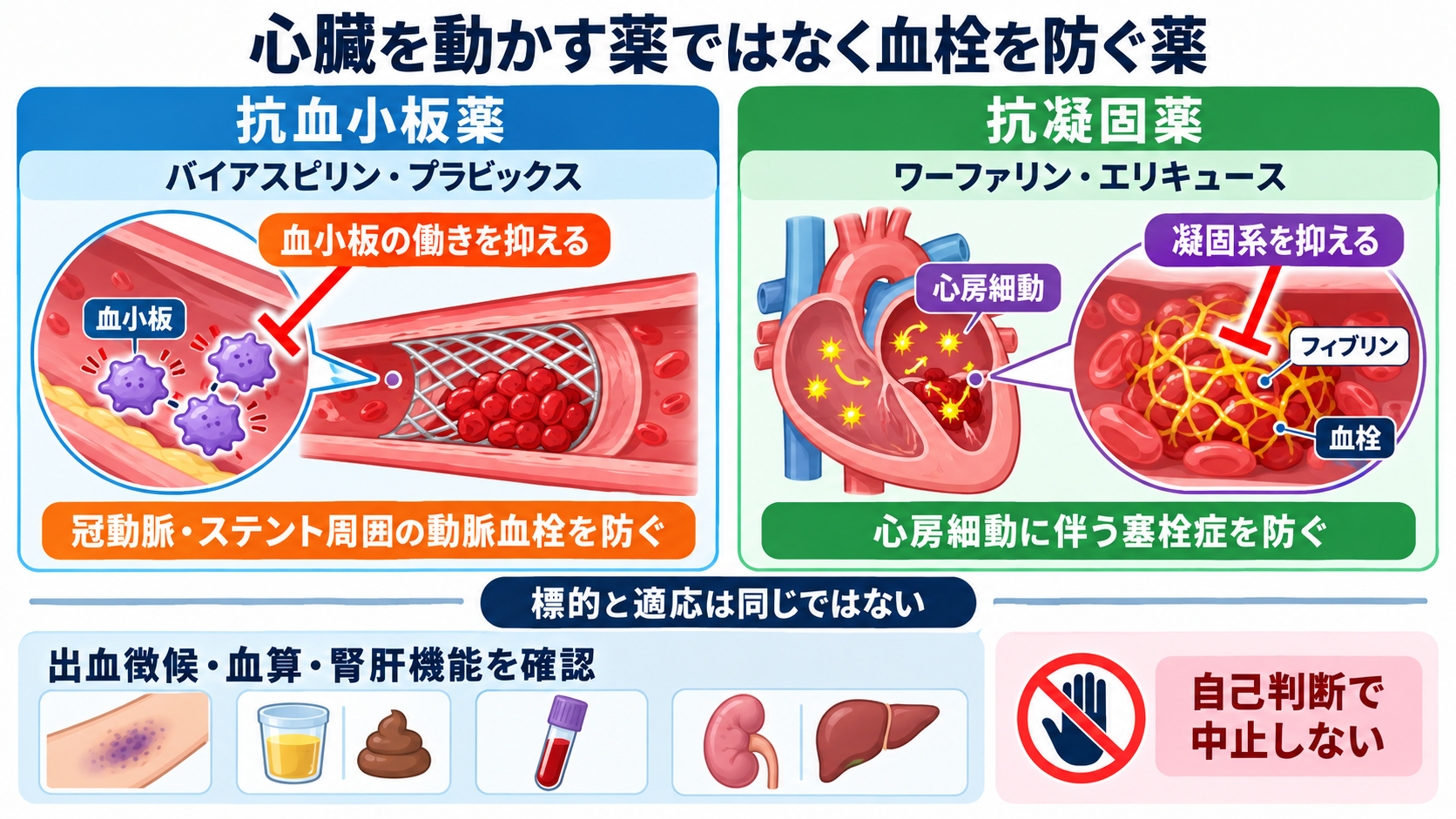 心臓の薬は何を変える？商品名からつなぐ作用と看護観察：抗血小板薬と抗凝固薬は、心臓を動かす薬ではなく血栓を防ぐ薬の図解