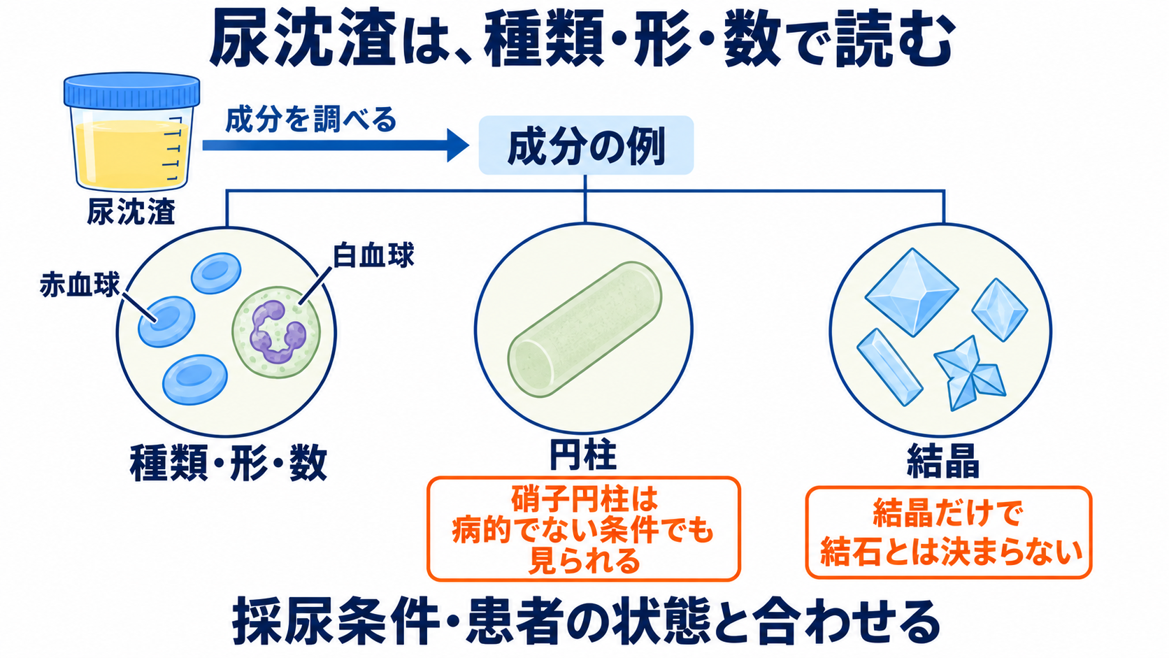 尿一般の項目一覧から、結果の読み方と看護での確認点を学ぶ：尿沈渣は、成分の種類と形から試験紙の結果を補うの図解