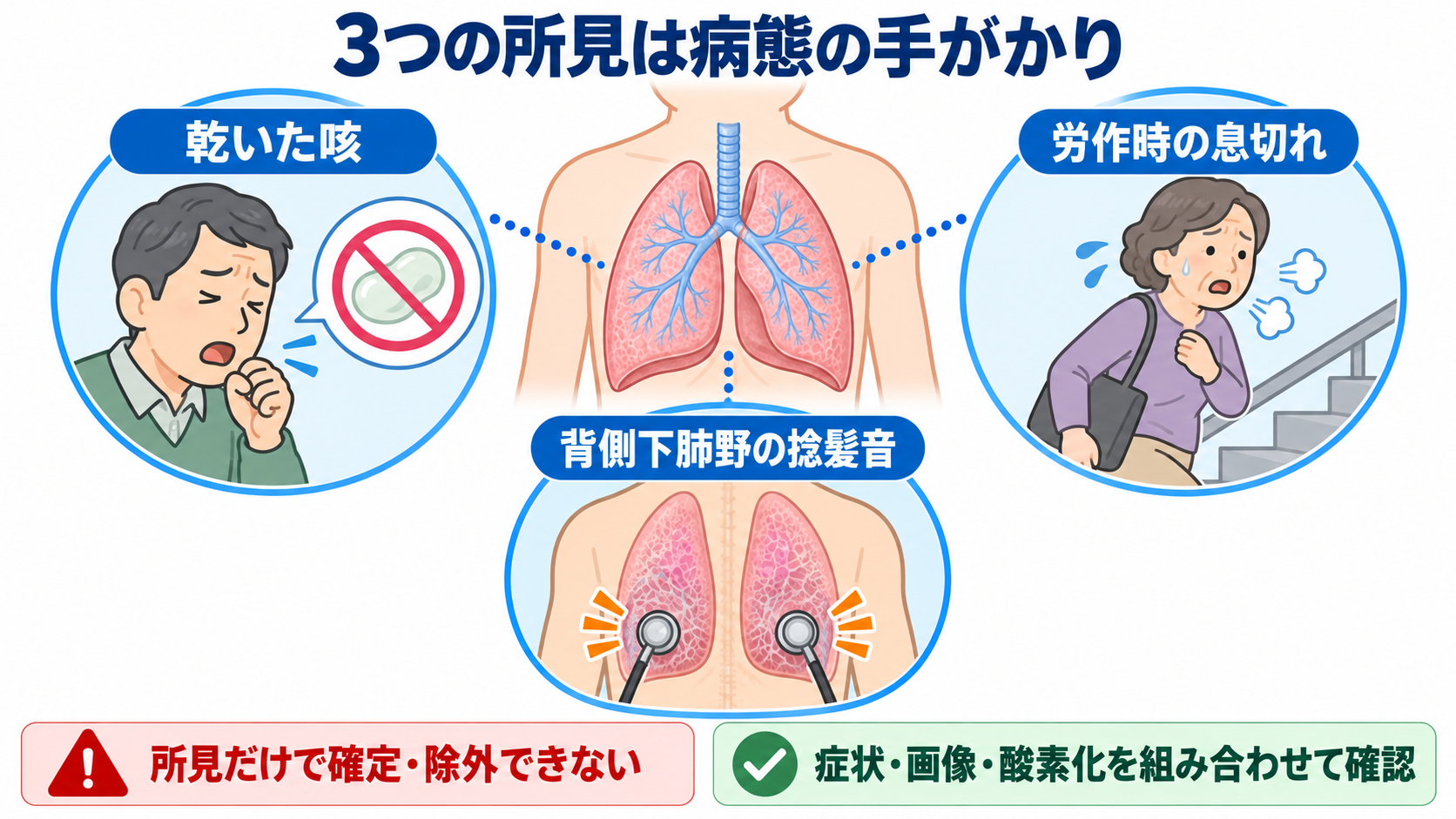 間質性肺疾患とは？病態・検査・治療から看護観察と急性増悪の見分け方まで：乾いた咳・労作時息切れ・捻髪音は、病態を示す手がかりであるの図解