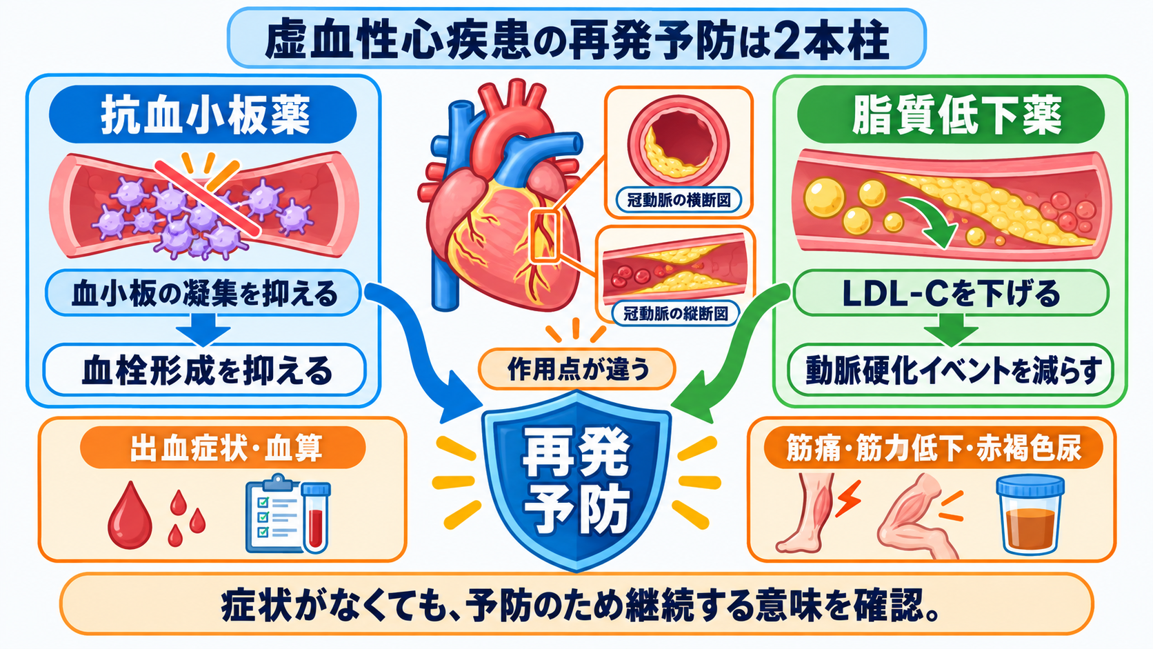 循環器で使われる薬剤を目的から理解する―作用・副作用と看護観察のつなげ方：虚血性心疾患では「血小板を抑える薬」と「動脈硬化を抑える薬」を併用するの図解