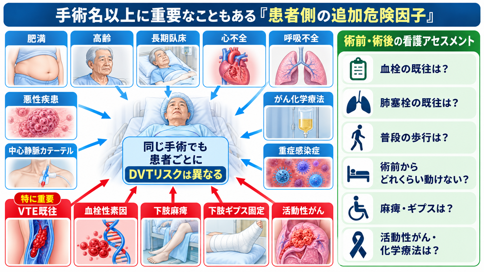 深部静脈血栓症を起こしやすい手術とは？術後DVTのリスクと予防・看護観察を解説：手術名以上に重要なこともある「患者側の追加危険因子」の図解