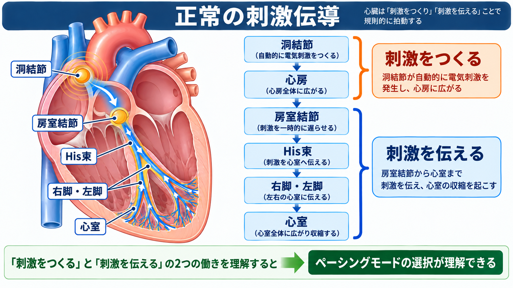 ペースメーカーの種類と適応を整理する｜VVI・DDD・リードレスから看護観察まで：正常では洞結節から房室結節、His-Purkinje系へ電気が伝わるの図解
