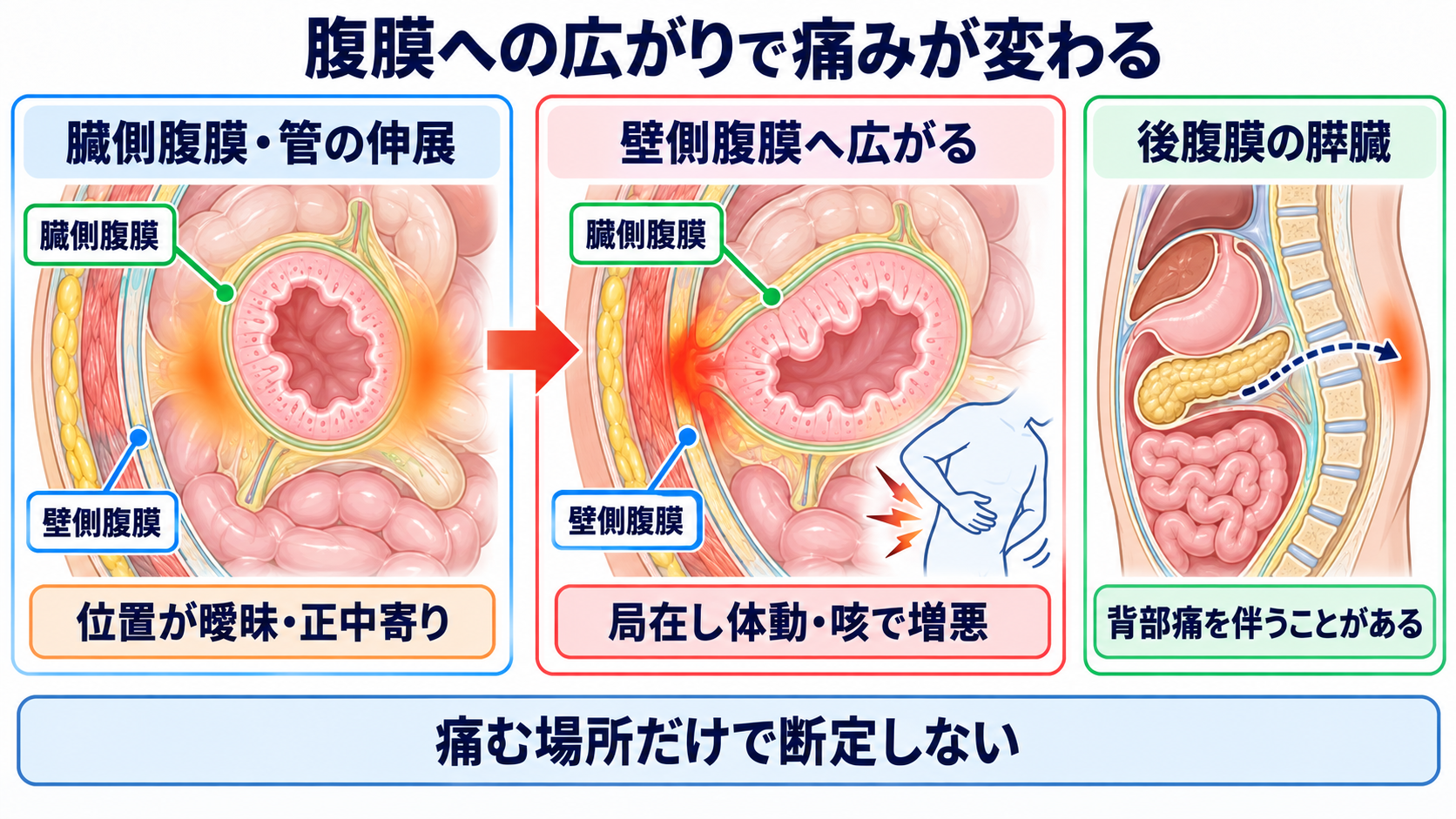 消化器の解剖を流れで理解する｜臓器・腹膜・血流と看護観察の意味：腹膜と後腹膜の位置関係が、痛みの広がりと症状の出方を左右するの図解