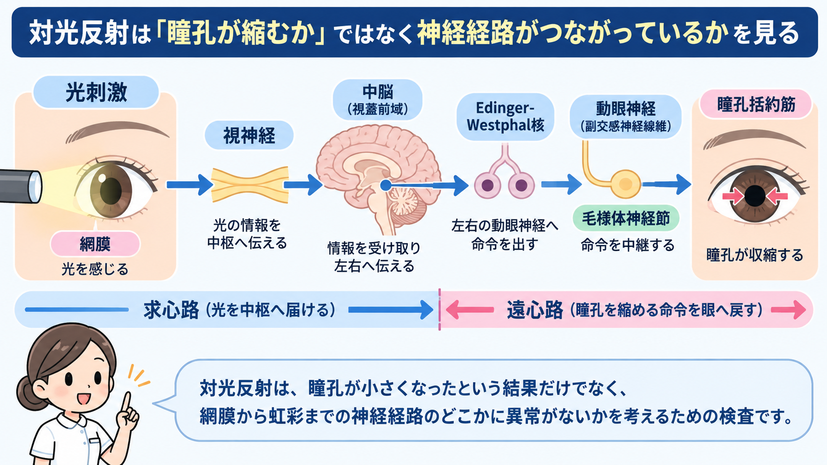 対光反射の見かた｜散瞳・縮瞳・瞳孔不同を症状別に理解する：対光反射は「瞳孔が縮むか」ではなく神経経路がつながっているかを見るの図解