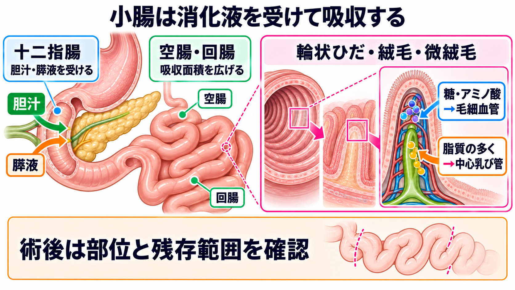 消化器の解剖を流れで理解する｜臓器・腹膜・血流と看護観察の意味：小腸は十二指腸で消化液を受け、空腸・回腸で吸収面積を広げるの図解