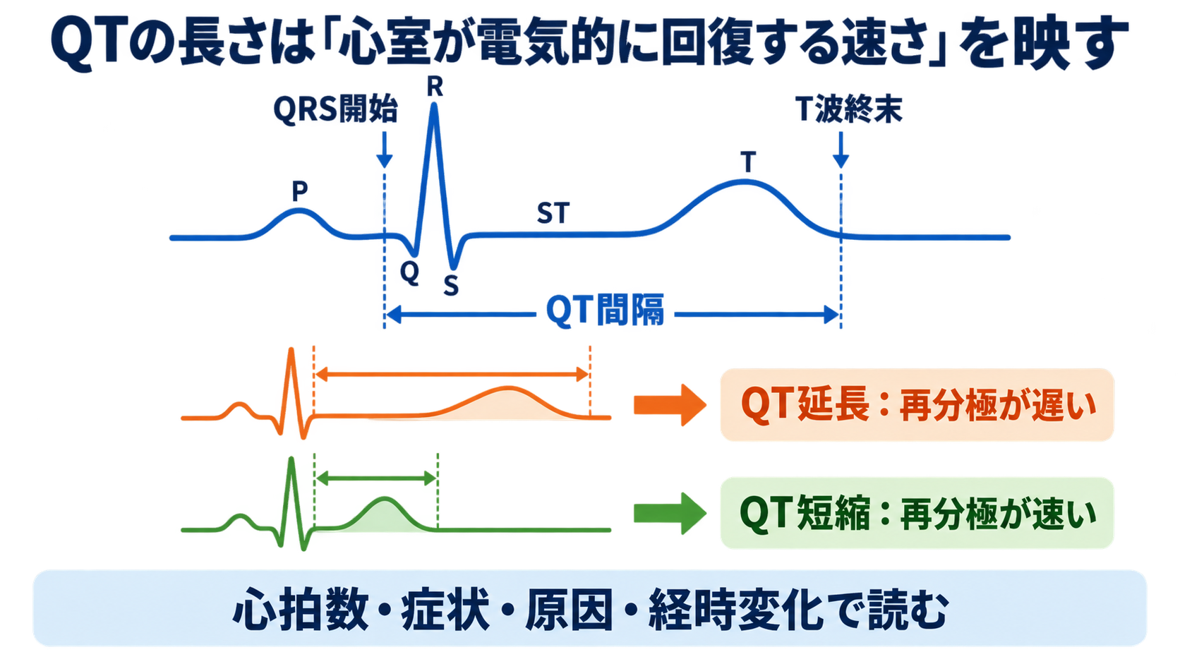 QT延長・QT短縮をどう読む？カルシウム異常、先天性・薬剤性LQTSと看護観察：QTの長さは「心室が電気的に回復する速さ」を映すの図解