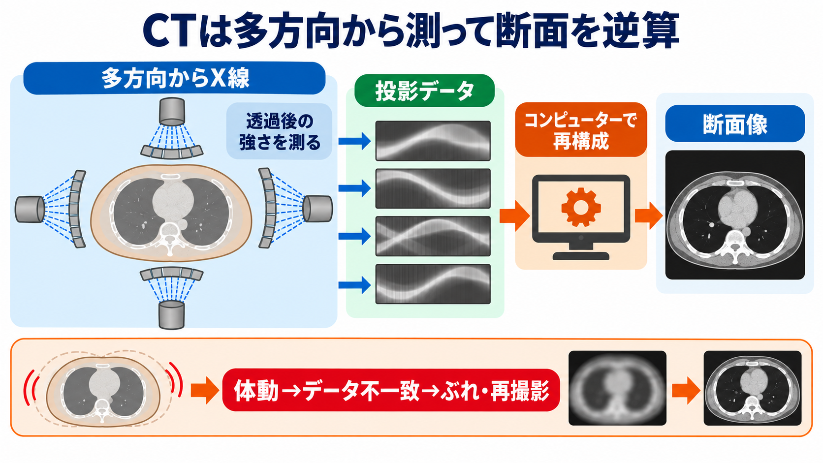 なぜ体の中が見える？CTとMRIを物理から理解する――画像の白黒と看護観察の意味：CTは、X線が弱まった量を多方向から集めて断面を逆算するの図解