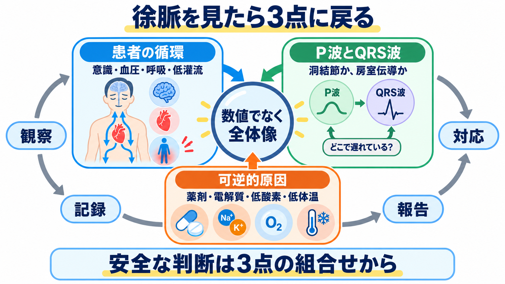 徐脈をどう見分ける？洞徐脈・SSS・徐脈頻脈症候群・房室ブロックの心電図と看護：徐脈を見たら「患者の循環」「P波とQRS波」「可逆的原因」の3点に戻るの図解