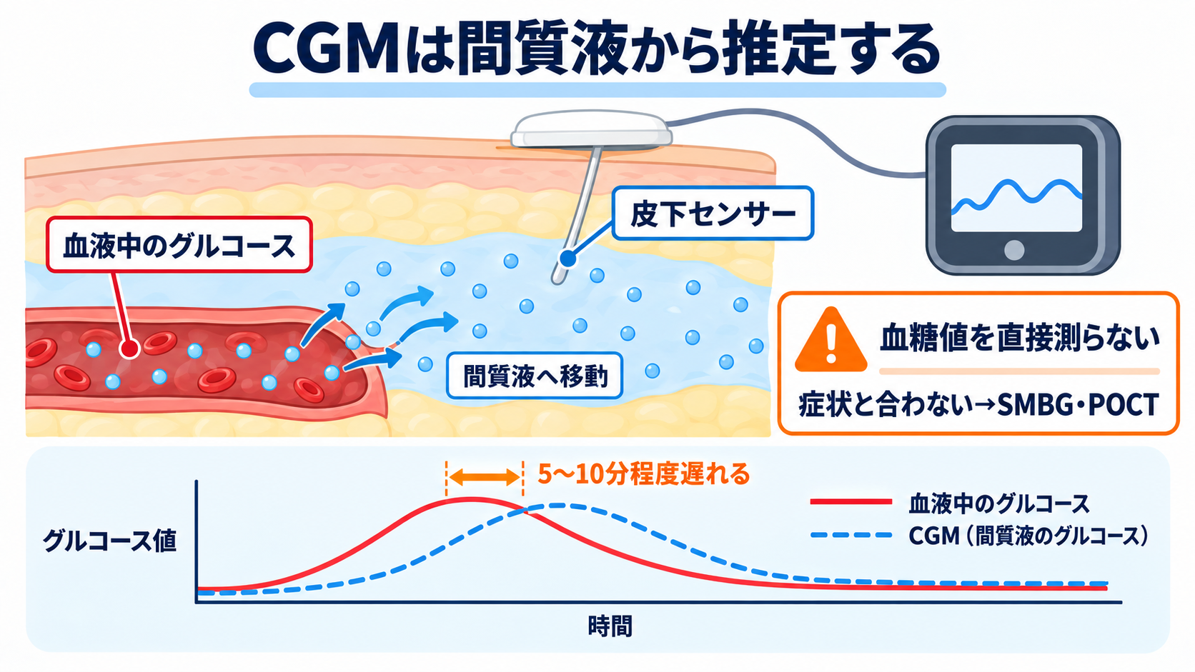 CGM・TIRの読み方｜血糖変動を看護アセスメントにつなげる手順：CGM値は血液中の血糖値そのものではなく、間質液からの推定値であるの図解