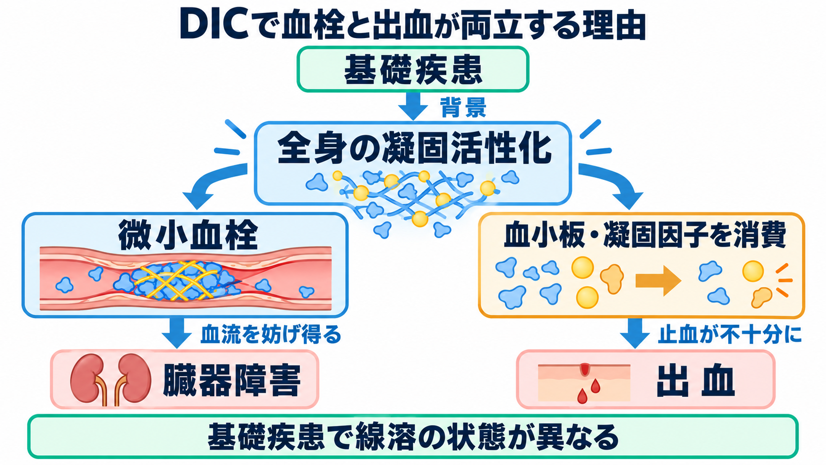 凝固・線溶検査の一覧と読み方――検査値を出血・血栓の観察につなげる：DICでは、血栓形成と止血材料の消費を同時に考えるの図解