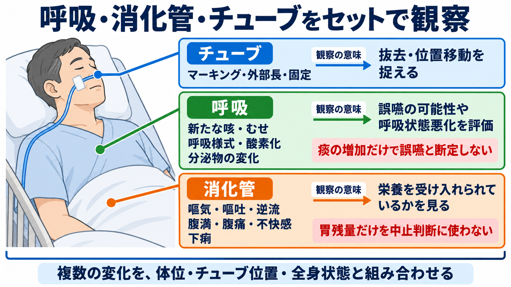経鼻経管栄養の使い方｜体位の基本とチューブ位置確認、誤嚥・閉塞を防ぐ注意点：注入中は「お腹」だけでなく、呼吸・チューブ・全身状態をセットで観察するの図解