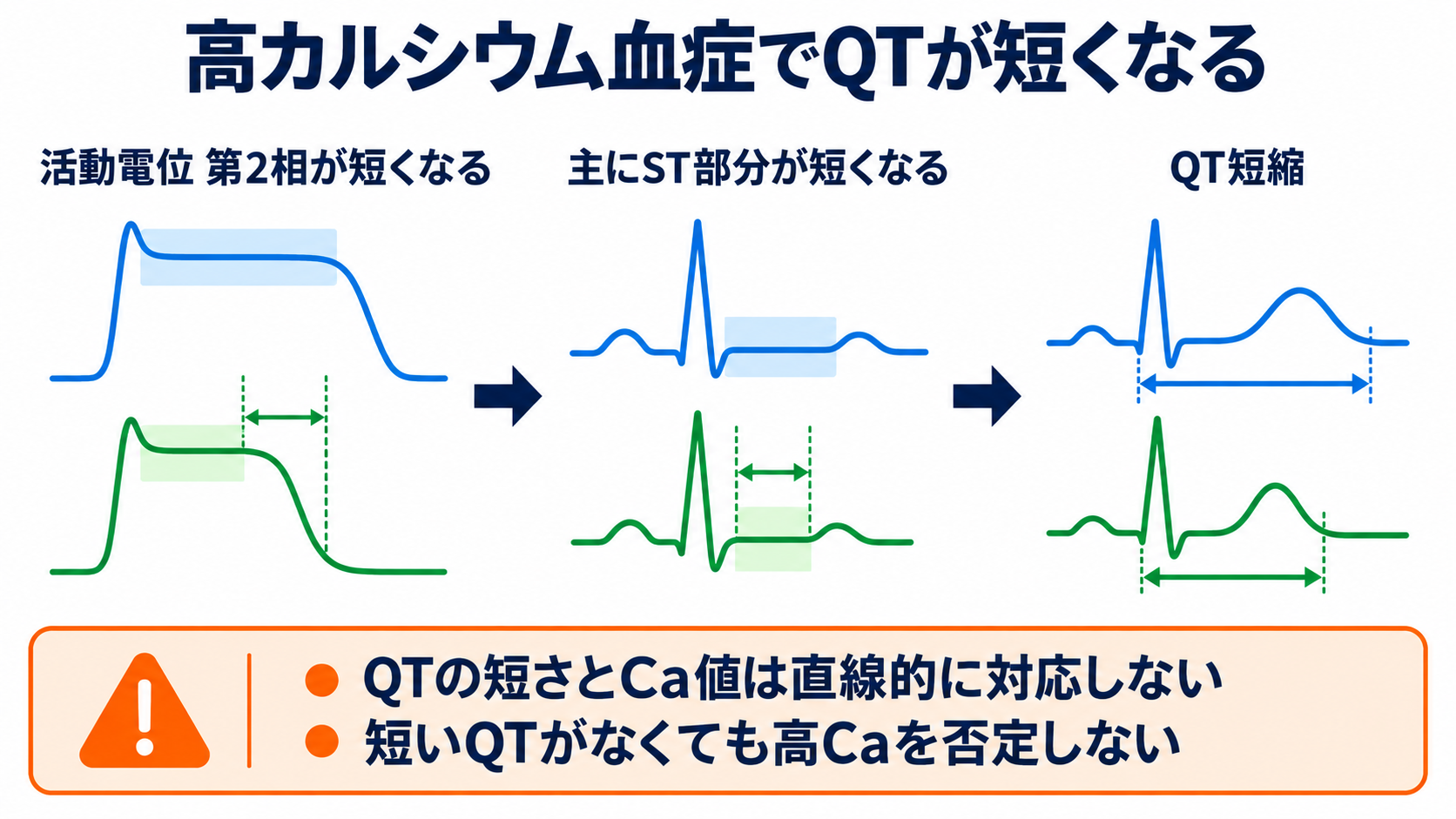 QT延長・QT短縮をどう読む？カルシウム異常、先天性・薬剤性LQTSと看護観察：高カルシウム血症では第2相が短くなり、QTは主にST部分から短縮するの図解