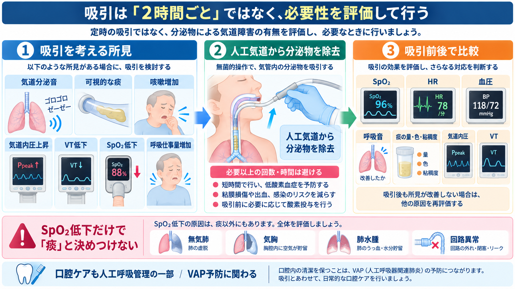 人工呼吸器のモードを理解する｜A/C・SIMV・PSV・CPAPの使い分け、設定、観察項目とアラーム対応：吸引は「定時にする処置」ではなく、分泌物による気道障害を評価して行うの図解