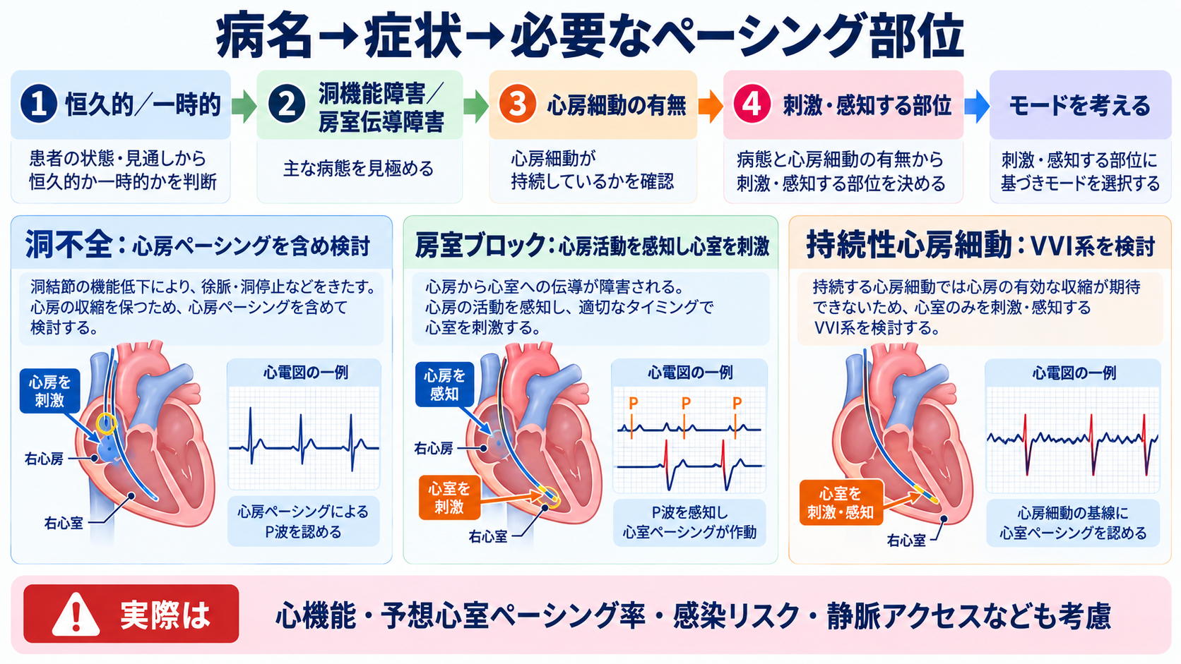 ペースメーカーの種類と適応を整理する｜VVI・DDD・リードレスから看護観察まで：適応を覚えるときは「病名→症状→必要なペーシング部位」の順で考えるの図解