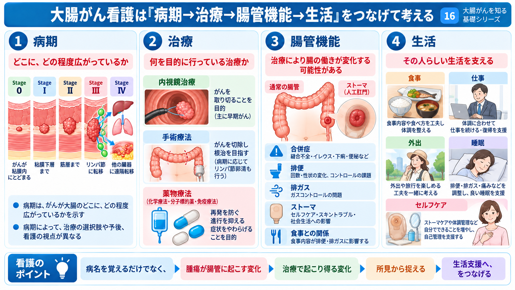 大腸がんとは？症状・検査・治療から術後の看護観察まで分かりやすく解説：大腸がん看護では「病期」「治療」「腸管機能」「生活」の4つをつなげて考えるの図解