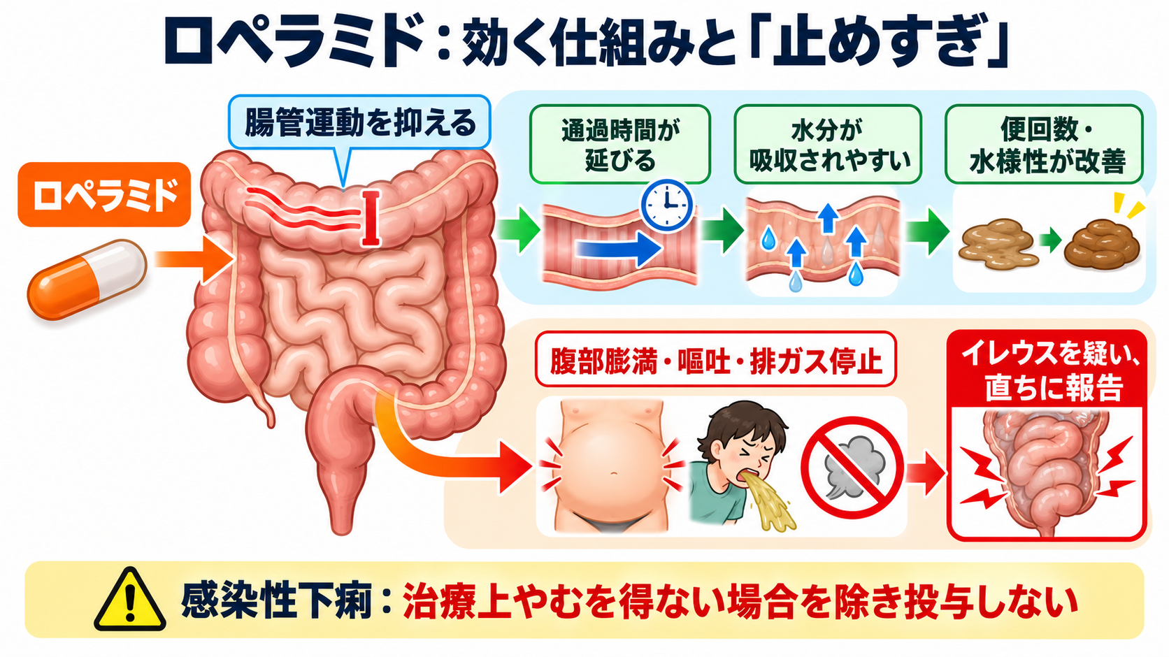 下痢止めの薬一覧｜作用の違い・使ってはいけない下痢・看護観察を解説：ロペラミドは有効性と「止めすぎ」の両方を考えるの図解