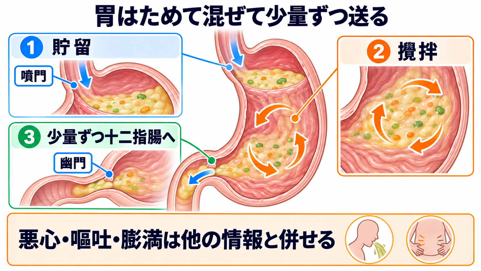 消化器の解剖を流れで理解する｜臓器・腹膜・血流と看護観察の意味：胃は食物をため、攪拌し、十二指腸へ少量ずつ送るの図解