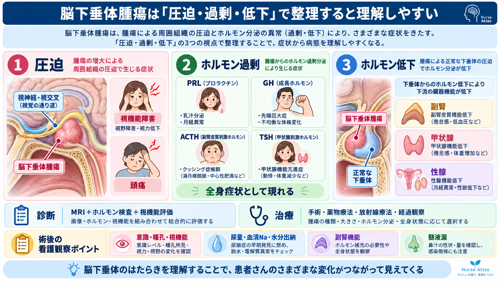 脳下垂体腫瘍とは？症状・ホルモン異常・治療と術後看護の観察ポイント：脳下垂体腫瘍は「圧迫・過剰・低下」で整理すると理解しやすいの図解