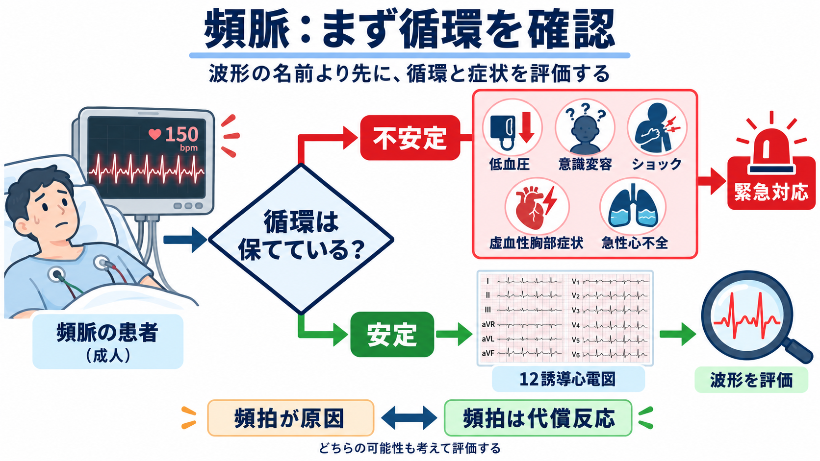頻脈の見分け方：洞性頻脈・PSVT・AVNRT・AVRT・SANRT・AT・2:1心房粗動を順番に理解する：頻脈を見たら、リズム名より先に「この頻脈で循環が保てているか」を判断するの図解