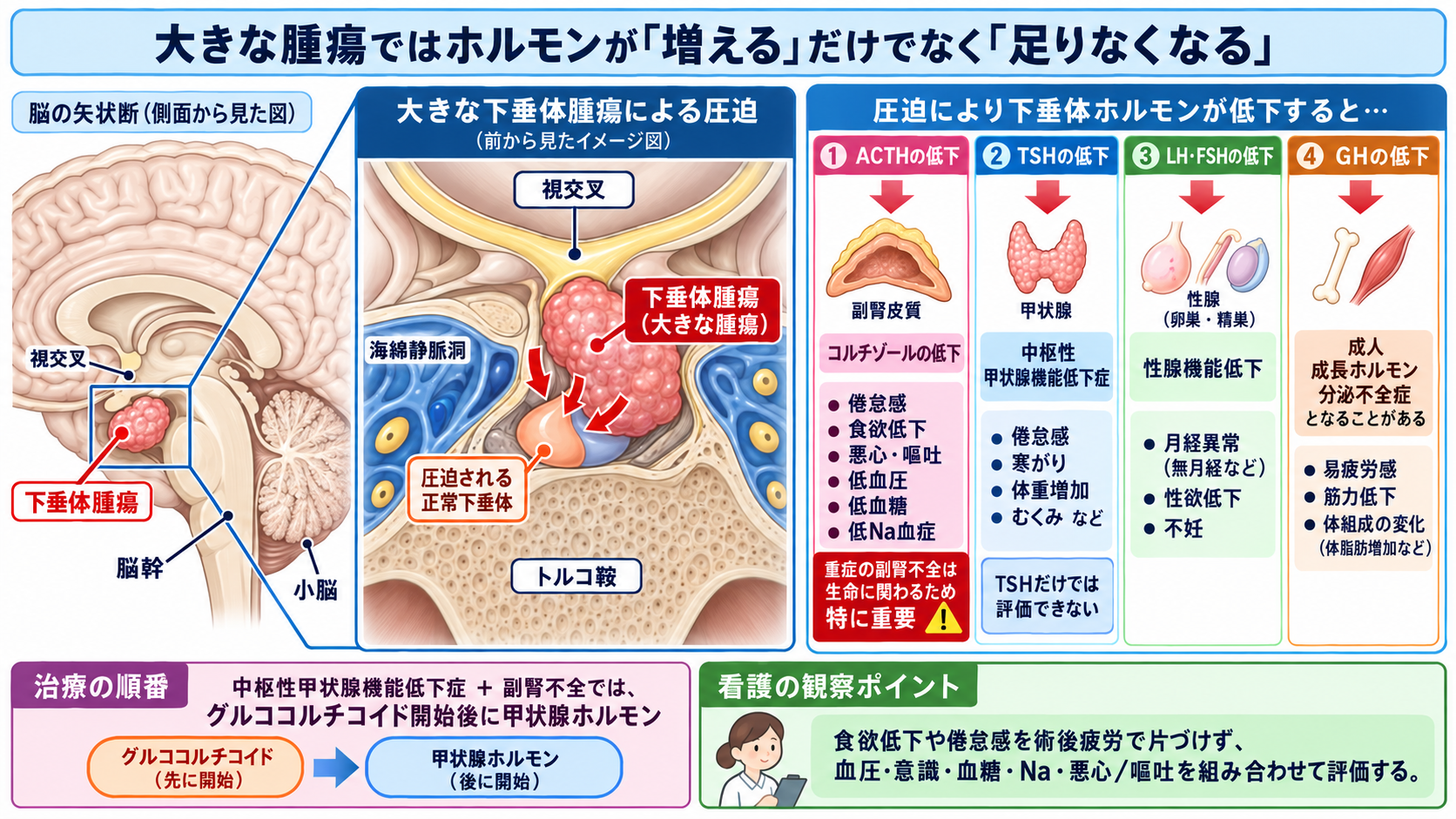 脳下垂体腫瘍とは？症状・ホルモン異常・治療と術後看護の観察ポイント：大きな腫瘍ではホルモンが「増える」だけでなく「足りなくなる」の図解