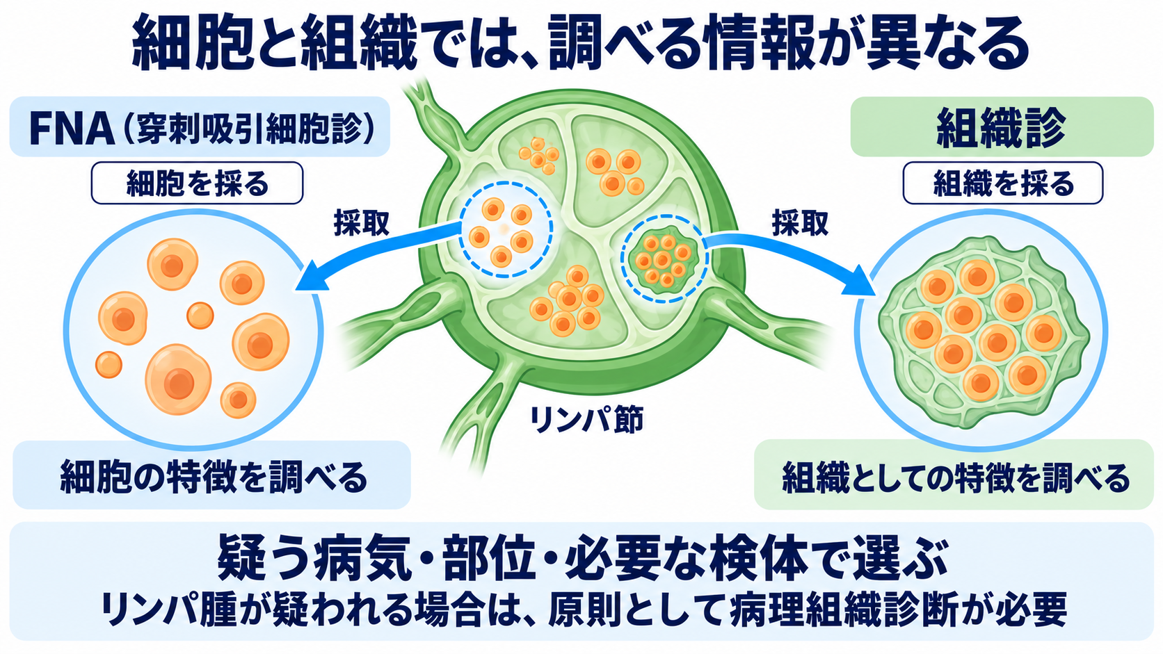 リンパ節の働きと腫れの見方を、看護の観察につなげる：生検の方法は、疑う病気と必要な検体によって変わるの図解