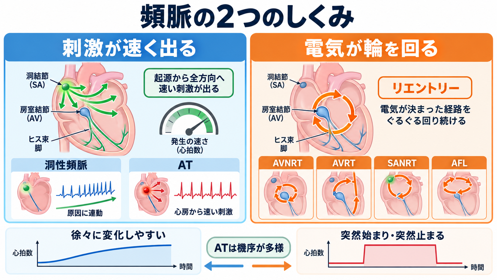 頻脈の見分け方：洞性頻脈・PSVT・AVNRT・AVRT・SANRT・AT・2:1心房粗動を順番に理解する：違いを理解する鍵は、「刺激が速く出る」のか「電気が輪を回る」のかにあるの図解