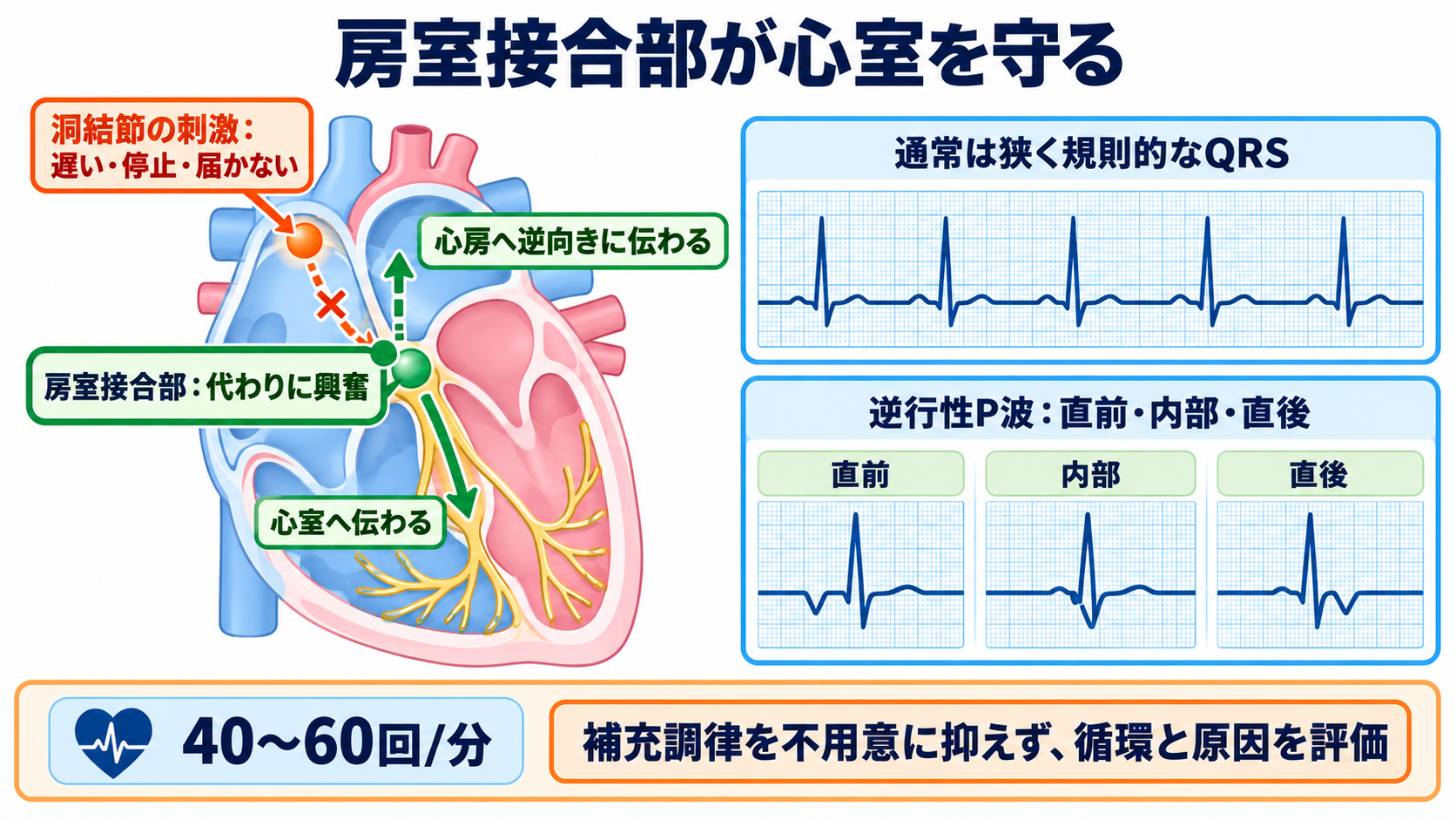 P-QRS関係で見分ける基本調律の異常―心房細動・接合部調律・固有心室調律・心房停止・洞室伝導：房室接合部調律は、下位ペースメーカーが心臓を守る補充調律でもあるの図解